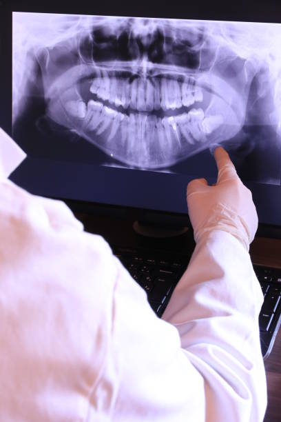 Best Emergency Dentist for Lost Fillings or Crowns in Milford, NJ